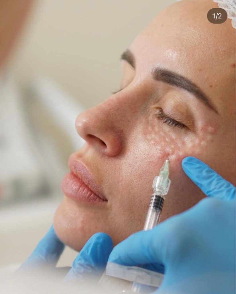 Skinbooster